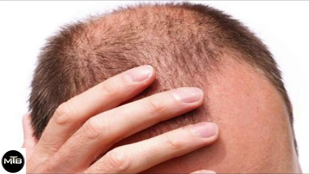 Magical Hair Growth Oil By Dr Khurram - Best Tip For Hair Regrow