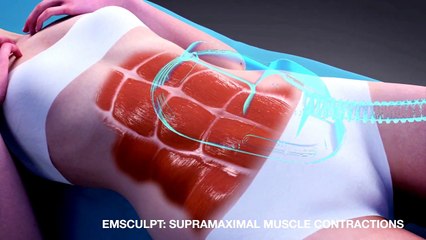 Clarity MedSpa_ Build Muscle and Burn Fat in Toronto (Emsculpt®)