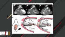 These Shark Embryos Swim From Uterus To Uterus And Devour Their Siblings