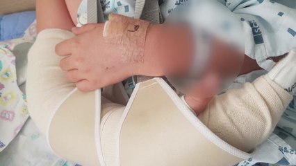 당진에서 이웃이 키우는 진돗개에 물려 어린이 중상 / YTN