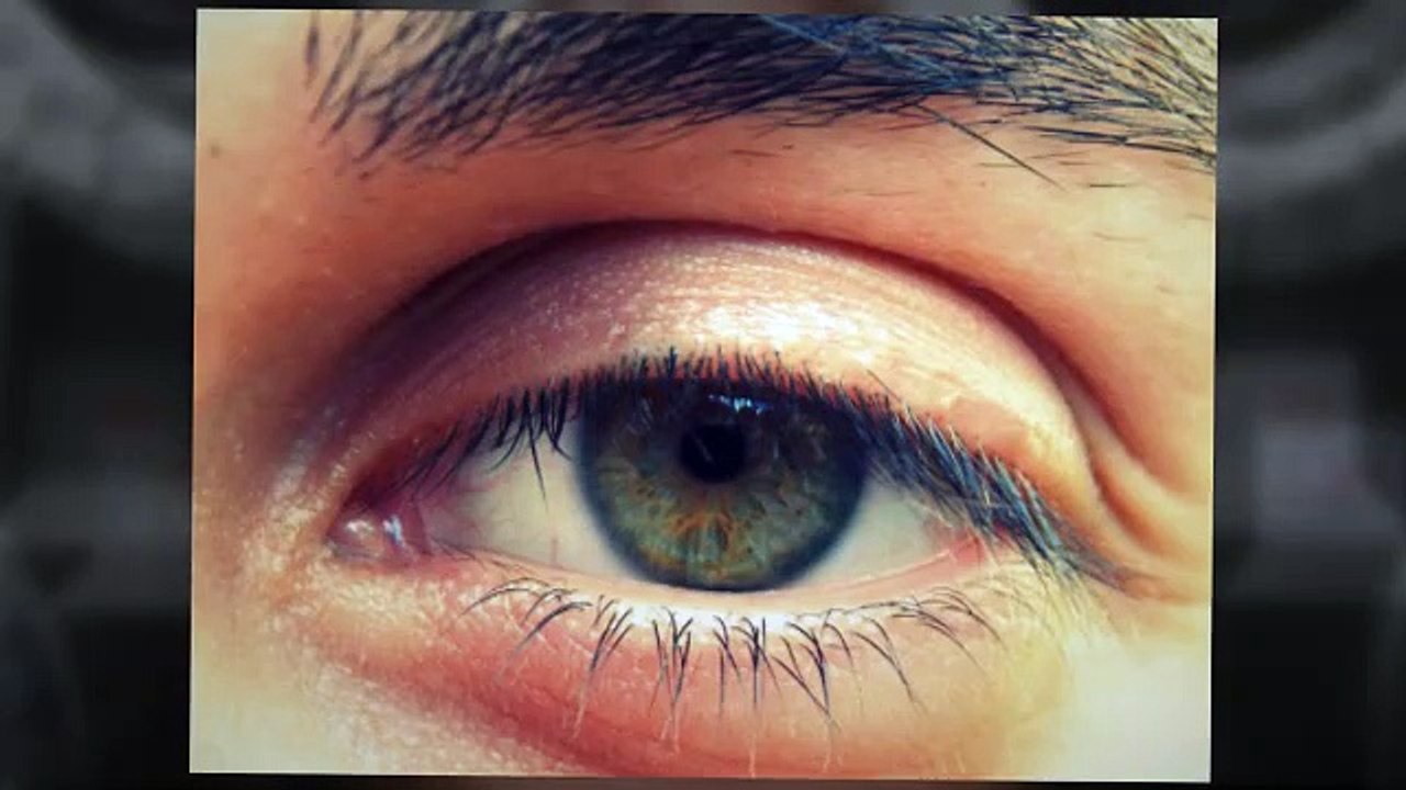 Eye Doctor in Torrance | clearchoiceoptometry.com | Call 3105389797