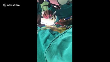 Man stays awake, chants Hindu prayer during three-hour long brain surgery in north India