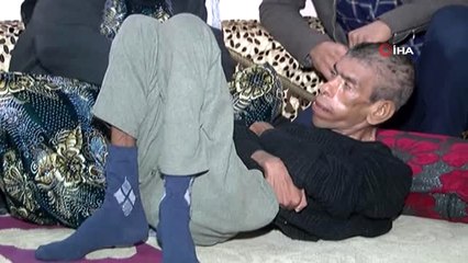 35 Yaşındaki Oğluna Bir Bebek Gibi Bakıyor