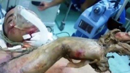 EL MUERTO VIVO - Testimonio Cristiano