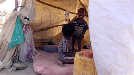 أسوشيتد برس: الفساد المالي سيؤدي لمجاعة غير مسبوقة باليمن