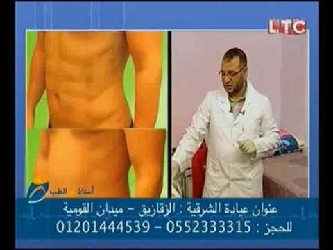 استاذ في الطب |مع د. محمد النجار حول سقوط الشعر وعلاج السمنه الموضعيه بالليزر -31 اغسطس 2016