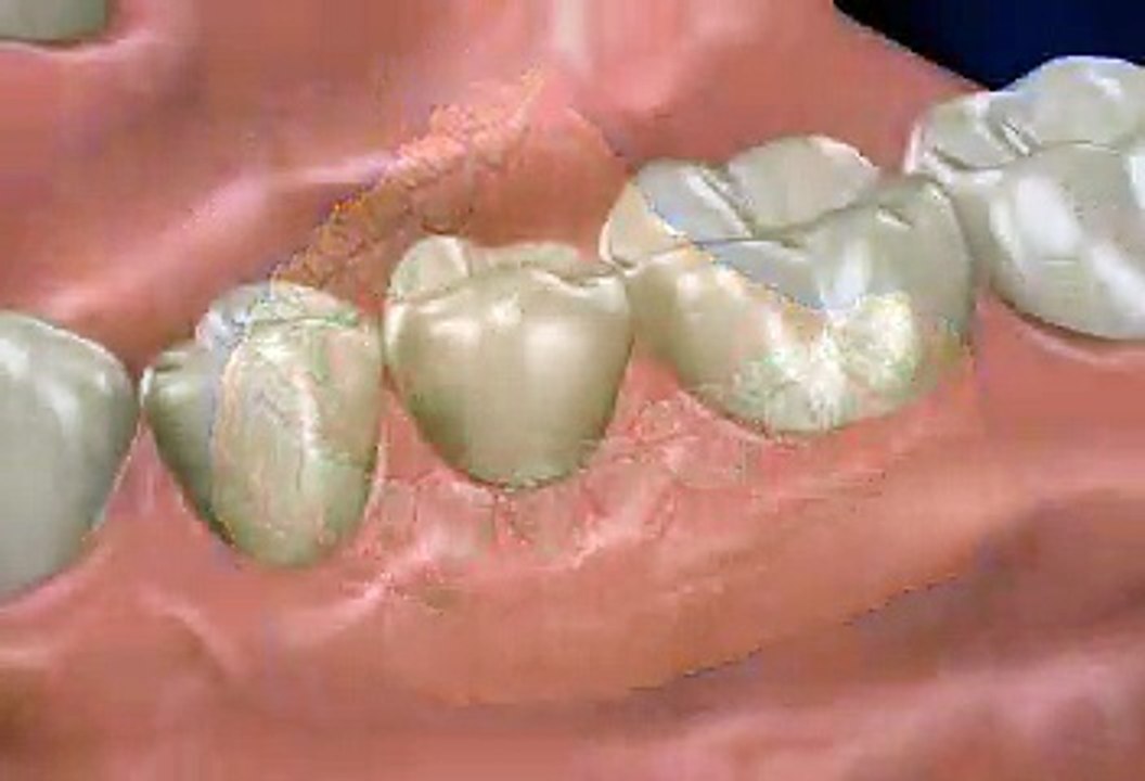 Oral_Hygiene_Instruction