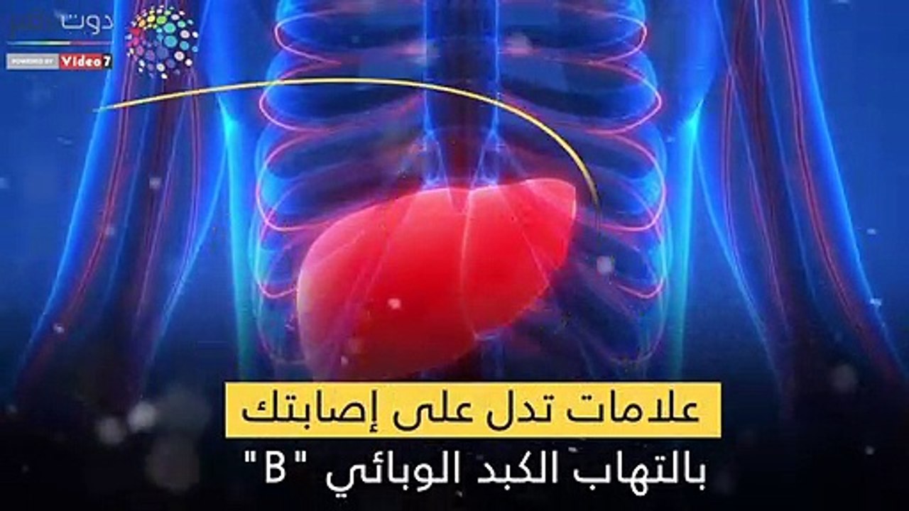 فيديو معلوماتي.. علامات تدل على إصابتك بالتهاب الكبد الوبائي  "B"
