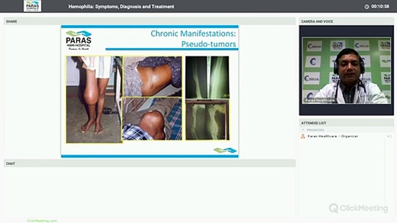 #ParasHospitalPatna - Hemophlia: Symptoms, Diagnosis and Treatment - Dr. Avinash Kumar Singh