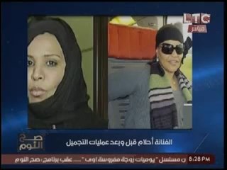 Video herunterladen: الغيطي يعرض صور المطربه احلام قبل وبعد عمليات التجميل مداعباً مخرج برنامجه:انت اللي عامل التجميل