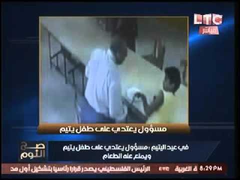 بالصور.. مسئول بدار رعايه يعتدي بوحشيه علي طفل يتيم وبلاغ لوزيرة التضامن