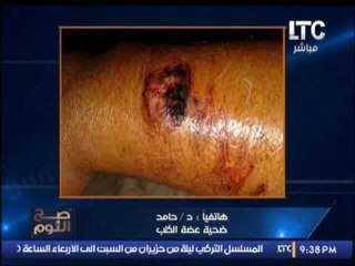 مواجهه ناريه عالهواء بين صاحبة كلب متوحش واحد ضحاياه والغيطي ينفعل عليها