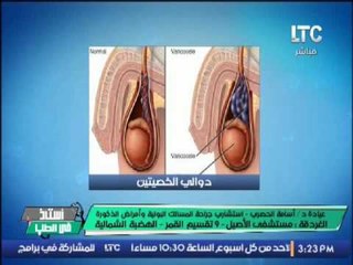 استاذ في الطب | مع شيرين سيف النصر و د. أسامه الحصرى "استشاري أمراض الذكورة " -19-10-2016