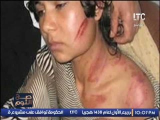 تقرير عن اليوم العالمى لــ " وقف العنف ضد المرأة "