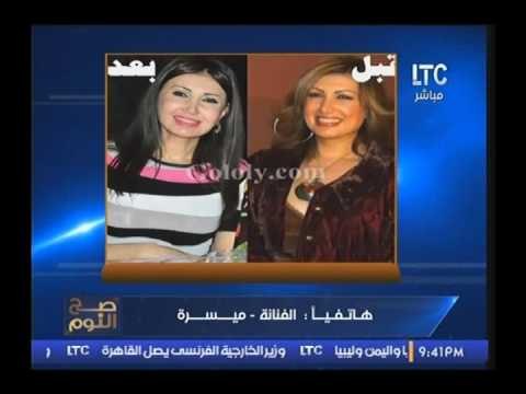 حصري بالفيديو.. الفنانه ميسره تكشف حقيقة تشوهه وجهها عقب خضوعها لعملية تجميل