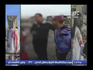 فضيحه مدويه- تصوير مشاهد تمثيليه دمويه لطفله في مصر ونشرها علي انها بـ حلب