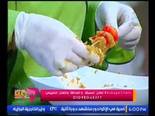 برنامج انتي احلي | مع د. باسم خليفه ..مطخبك دايت :"شيش طاووق-خضار سوتيه- ارز بسمتي" 23-2-2017