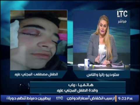 والدة الطفل المجنى عليه بفقع عينة تروى الاعتداء على ابنها و تبرئ زميل ابنها على الهواء