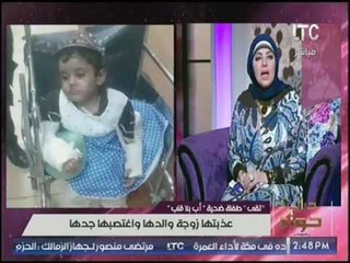 بالصور | تعذيب طفله  ببشاعه بتكسير ذراعيها وقطع انفها من زوجة ابيها