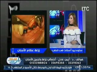 استاذ في الطب | مع شيرين سيف النصر و د . ايمن عادل اخصائي زراعة وتجميل الاسنان 6-5-2017