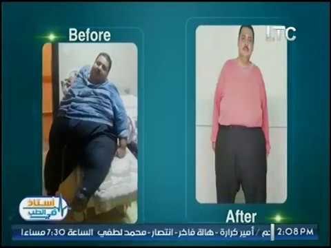 برنامج استاذ في الطب|مع شرين سيف النصر ولقاء د.كريم صبري استشاري السمنة والمناظير-2-6-2017