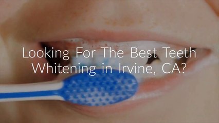 WOODBRIDGE DENTISTRY : Teeth Whitening in Irvine