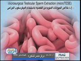 برنامج استاذ في الطب | د. خالد سالم حول استخلاص الحيوانات المنوية من الخصية 10-8-2017