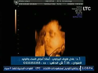 برنامج حدث سعيد | مع د. عادل فاروق البيجاوي حول الاسبوع ال 29 في رحلة الحمل 8-9-2017