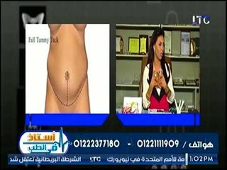 برنامج أستاذ في الطب | د. ولاء ابوالحجاج حول علاج السمنة بإزالة الدهون وشد الجلد 17-9-2017