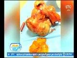 برنامج استاذ في الطب | مع شيرين سيف النصر ود.جمال البحيري حول اورام الرحم-18-9-2017