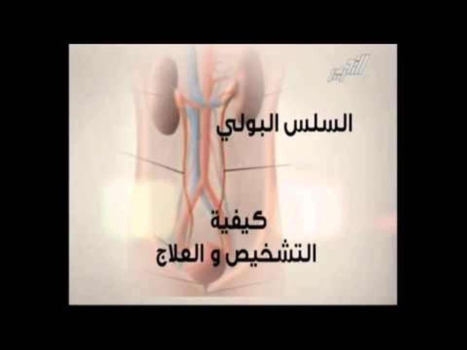 للنساء فقط    السلس البولي   كيفية التشخيص والع...