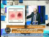 تعرف على خطورة مرض 