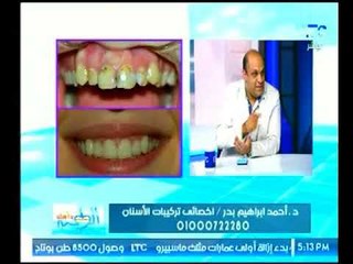 برنامج الطب وأهله | مع نورهان شبل ود.أحمد إبراهيم حول تركيبات الأسنان-3-10-2017