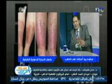 برنامج استاذ في الطب | مع شيرين سيف النصر ود.عادل الفرجاني حول الجلطات القلبية-18-10-2017