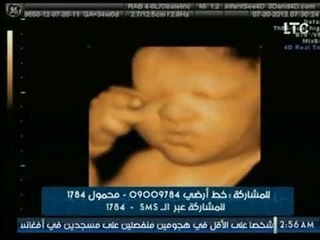برنامج حدث سعيد | مع د . عادل فاروق البيجاوي حول الاسبوع الـ 34 من رحلة الحمل 20 -10 -2017