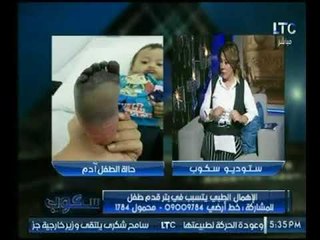 والد الطفل "آدم" ضحية خطأ طبى يكشف لـ "سكوب " الإهمال الطبى الذى تعرض له ابنه