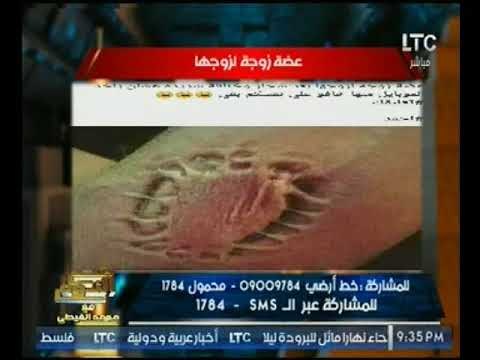 الغيطي عن الصوره المتداوله لغض سيده لزوجها : كويس انها في ايده مش في حته تانيه