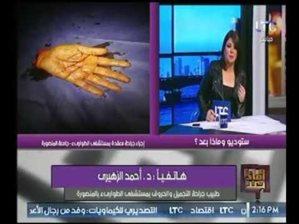 طبيب جراحة مستشفى المنصورة يكشف تفاصيل مرعبة حو...