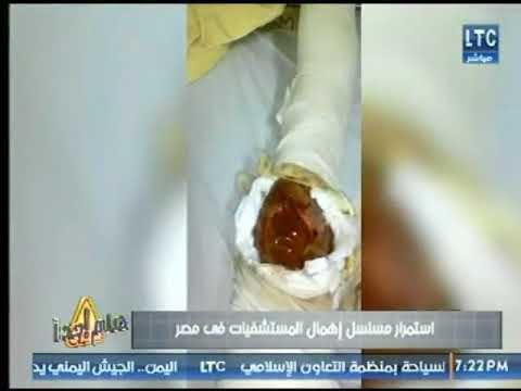 كاميرا هام جدا تكشف إهمال الأطباء لـ المرضي داخل المستشفيات في مصر وتعليق ناري لمحمد أ[و العلا
