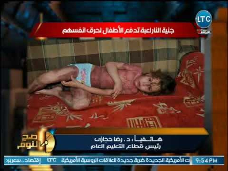 صح النوم - صح النوم يكشف علي غرار "الحوت الازرق...