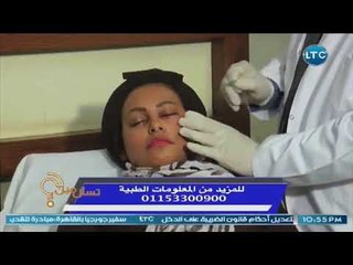 برنامج تسأل مين | مع شيري صالح و ا.د. حسن الفكهاني حول الاكياس الدهنية في العين  15-4-2018