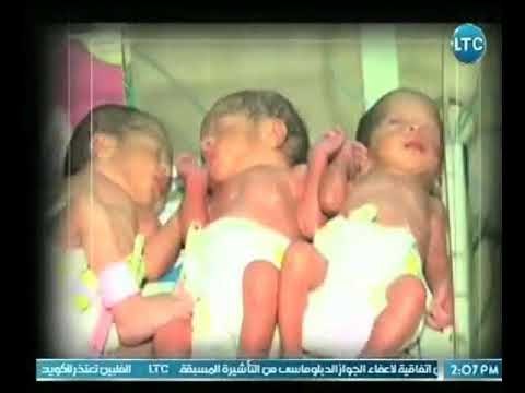 برنامج حلم عمري | مع هبه الزياد ود. محمد مقبل حول علاج مشاكل الانابيب 25-4-2018