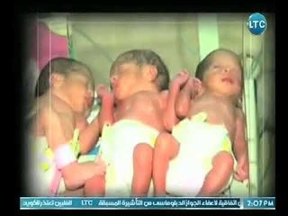 برنامج حلم عمري | مع هبه الزياد ود. محمد مقبل حول علاج مشاكل الانابيب 25-4-2018