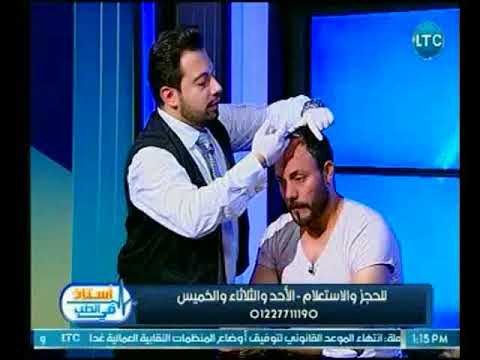 وداعا لمشكلة الصلع .. تعرف علي احدث طرق زراعة الشعر أمن بشكل كامل