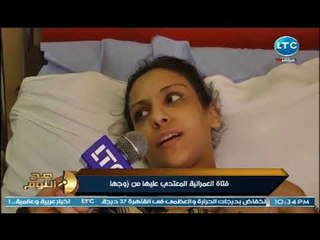 ابشع اعترافات لفتاه قبطيه تعرضت للتعذيب ومحاولة قتل من زوجها لسبب لايتخيله احد