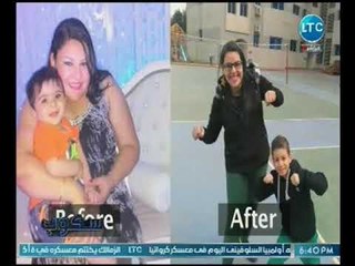 سكوب | مع جيهان عفيفي لقاء مع د. جرجس لاوندي حول جراحات السمنه المفرطه 6-7-2018