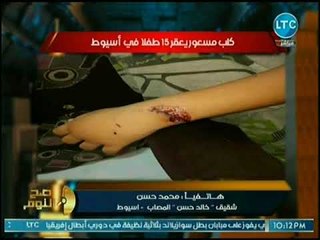 صح النوم - لفظ (+18) من الغيطي على الهواء بسبب التعامل الطبي مع طفل عقره كلب مسعور بأسيوط