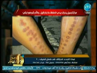 محمد الغيطي يفضح مراكز التجميل والعلاج بالليزر بعد تسببها في تشويه جسد فتاتين