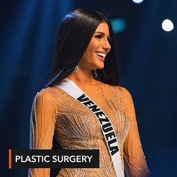 Miss Universe 2nd runner-up Sthefany Gutierrez's before and after photo goes viral