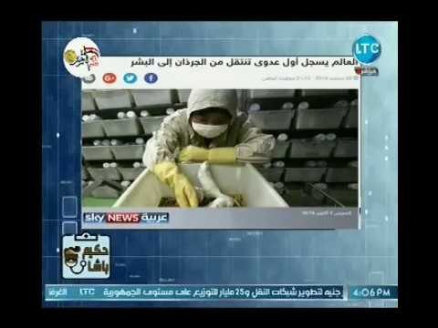 تحذير هام | العالم يسجل اول عدوي تنتقل من الجرذان الي البشر